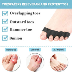 WEU separadores-dedos-pie-4pcs-superposicion: reducen la fricción entre dedos y evitan la superposición.