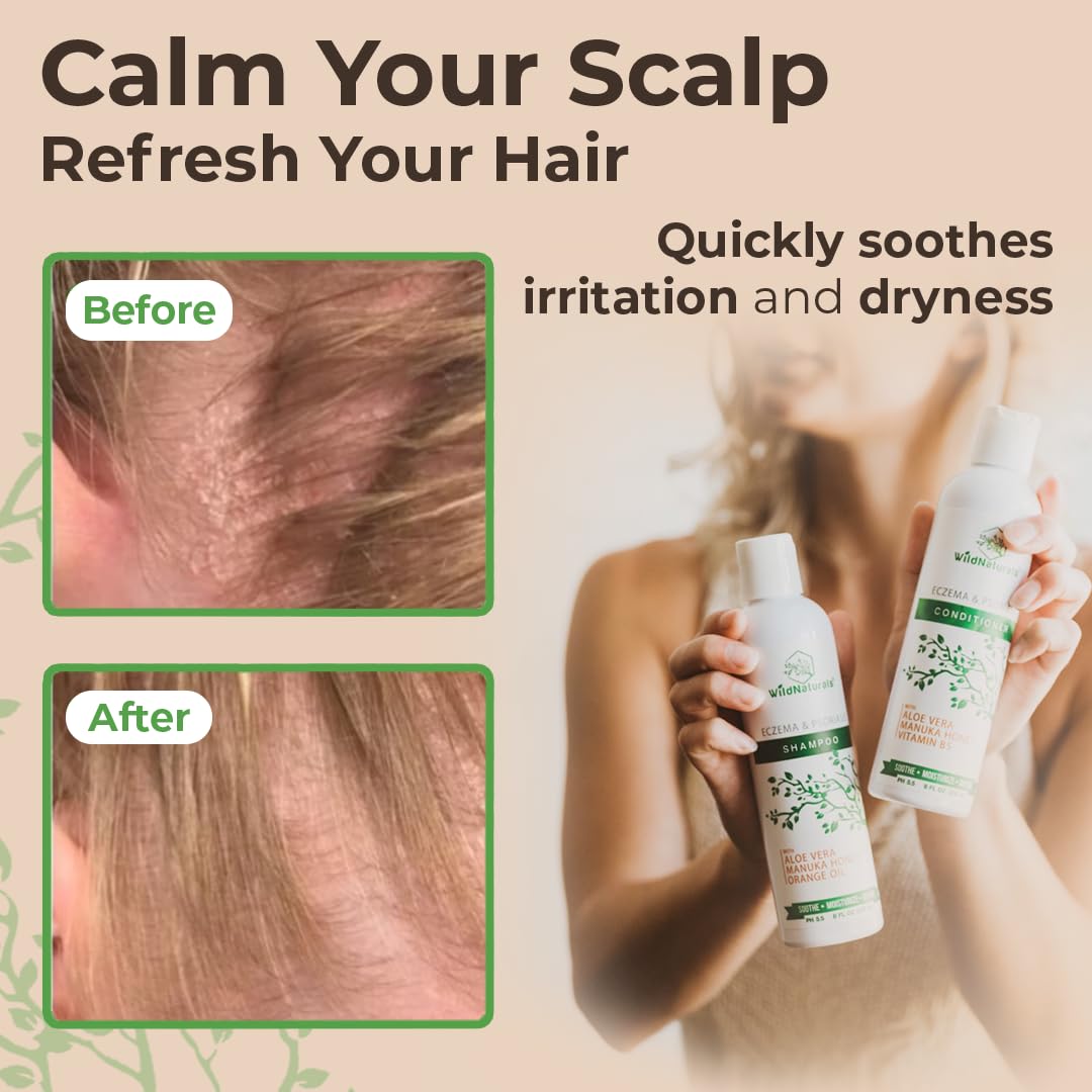 Base de aloe vera en Wild Naturals, frasco, textura ligera.