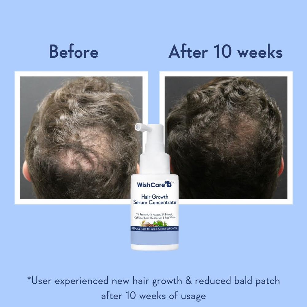WishCare scalp application close-up showing easy massage