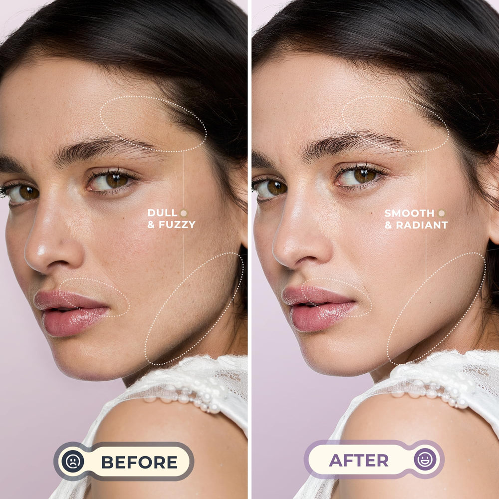 Tres velocidades ajustables de WLU para dermaplanado suave y preciso.