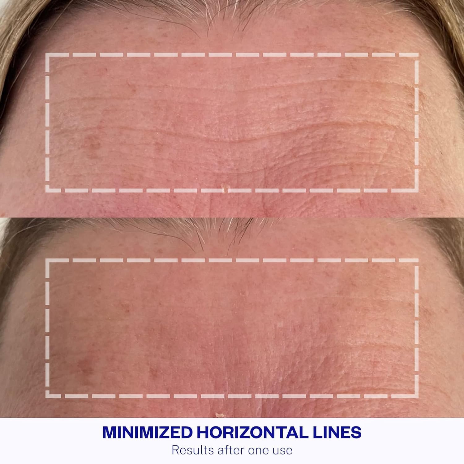 Uso diario de Wrinkles Schminkles para mantener la piel suave.