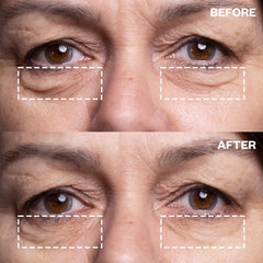 Wrinkles Schminkles parches de ojos mejoran la apariencia de líneas y patas de gallo