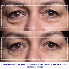 Silicona médica Wrinkles Schminkles, fabricada en EE. UU., para piel sensible.