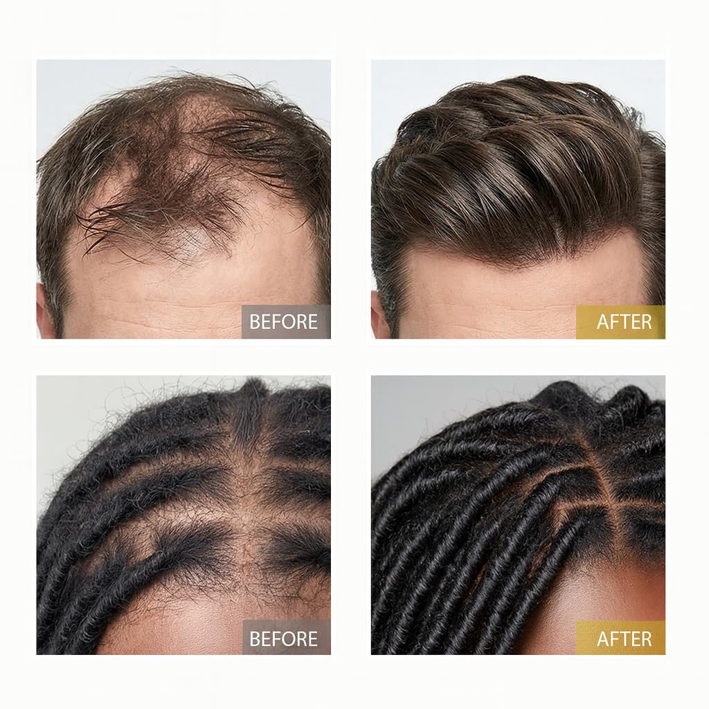 XILRVON Aceite puro sin químicos, aporta hidratación natural para cabello seco.