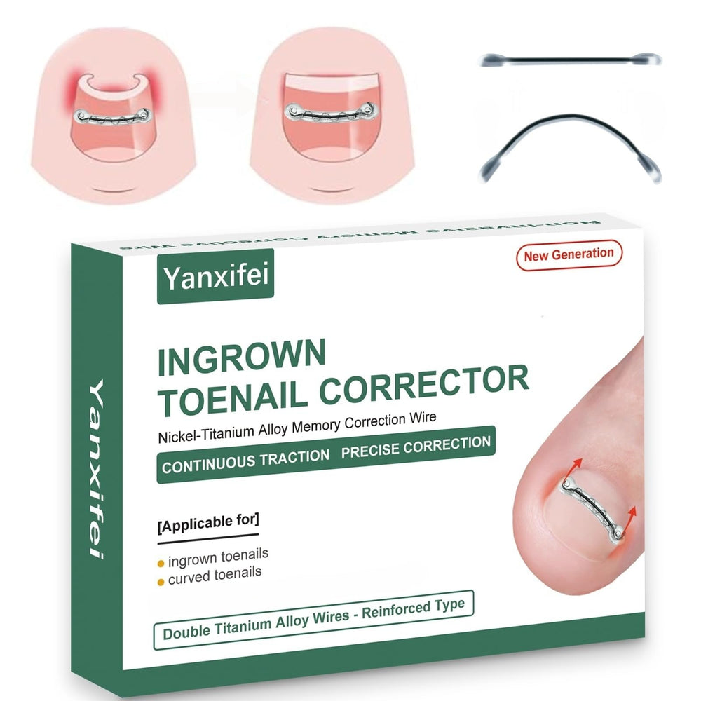 Yanxifei Corrector de Nitinol para uña encarnada, listo para iniciar tratamiento en casa