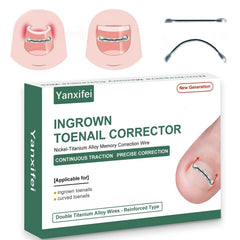 Yanxifei Corrector de Nitinol para uña encarnada, listo para iniciar tratamiento en casa