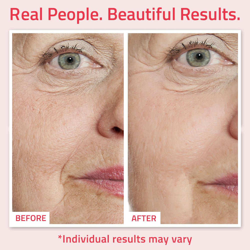 yeouth retinol serum, gota en la piel con sensación de firmeza
