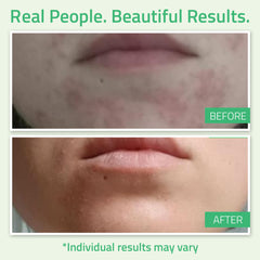 yeouth te verde retinol ingredientes destacados para piel mas clara
