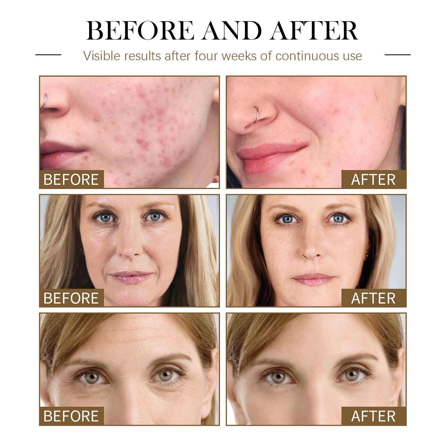 Aplicación suave de aceites faciales YG LianKai para rostro