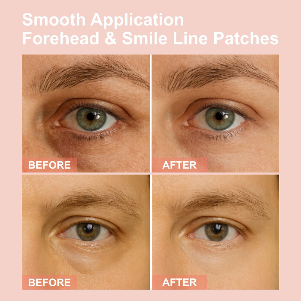 Aplicación de parches oculares para cuidado suave y cómodo