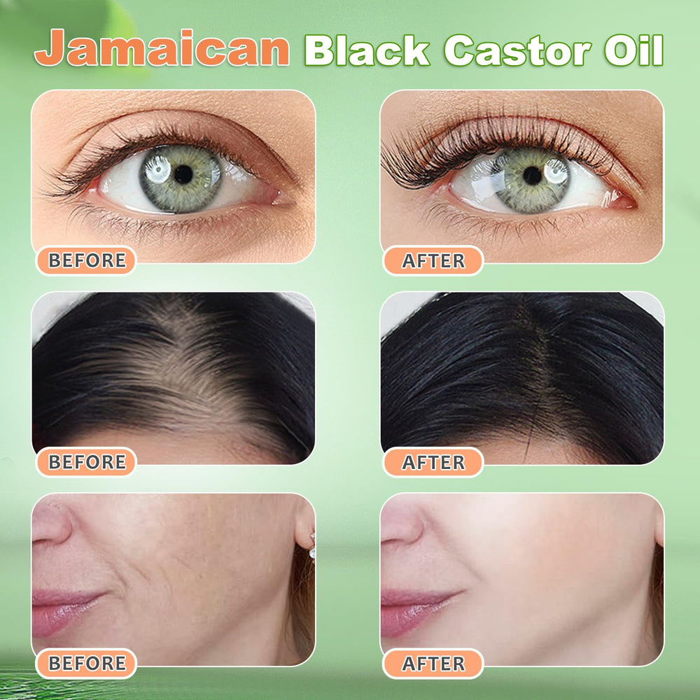 YLXYZUAD Aceite de castor jamaicano para aplicación capilar y fortalecimiento del cabello.