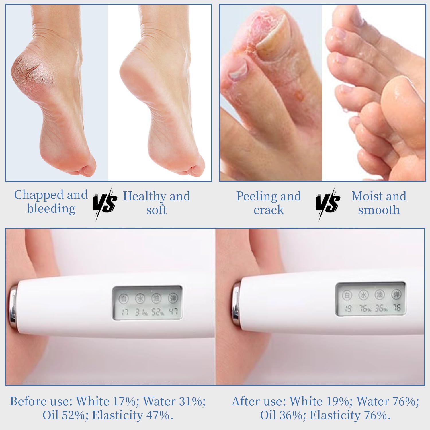YOUNGYOUNGLOVE crema de urea 70% aroma fresco para cuidado diario