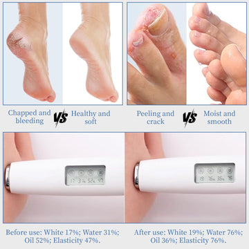 YOUNGYOUNGLOVE crema de urea 70% aroma fresco para cuidado diario