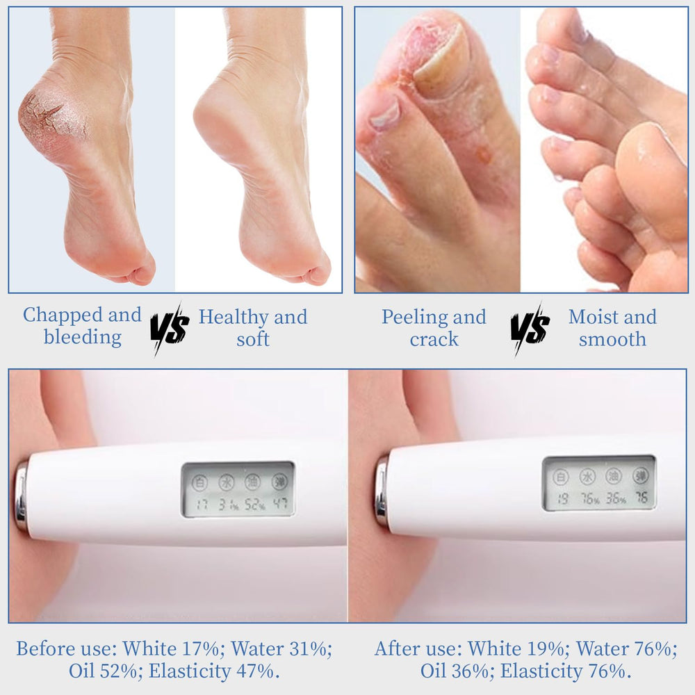 YOUNGYOUNGLOVE crema de urea 70% aroma fresco para cuidado diario