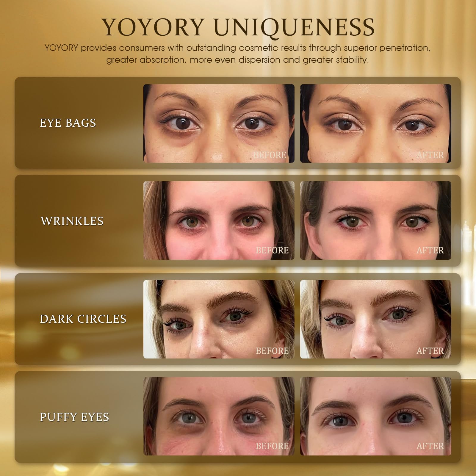 Parche YOYORY de ojos con hidratación intensa para la mirada.