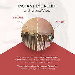 Zocular ZocuWipe: limpieza de los márgenes del párpado para una sensación fresca.