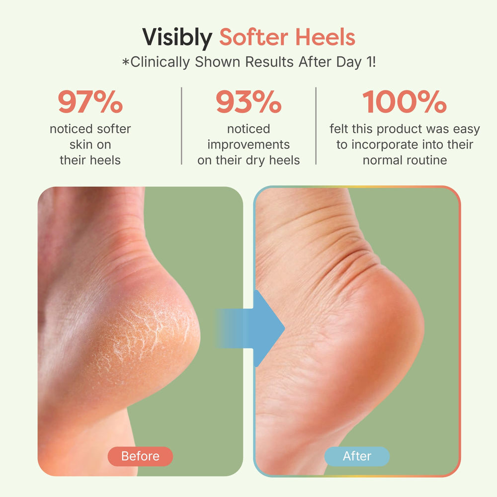 ZenToes aceite de jojoba y oliva con vitamina E para hidratación profunda.