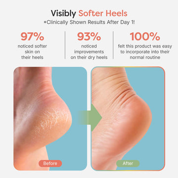 Aceites oliva y jojoba con vitamina E en ZenToes.