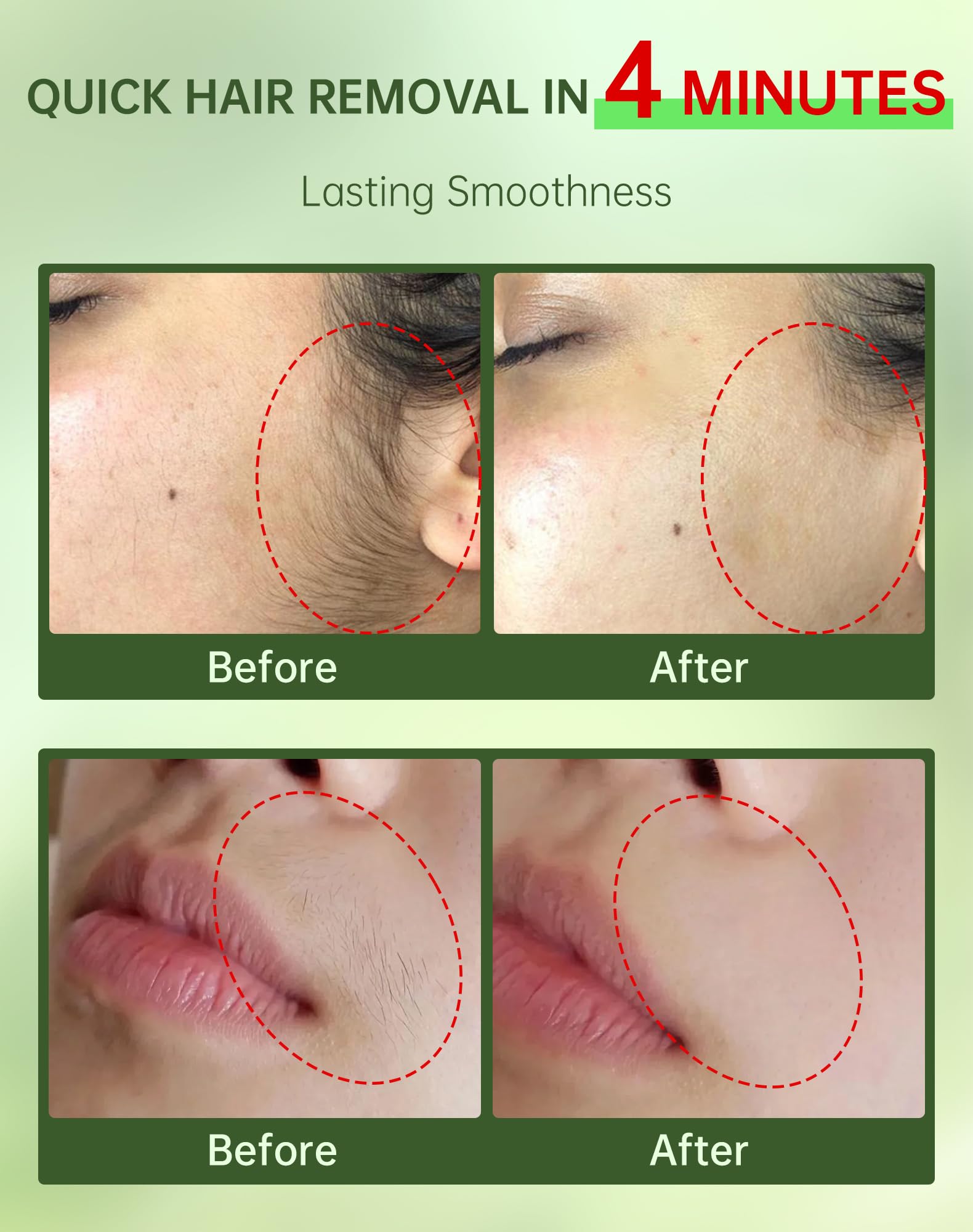 Zeponyx aplicación rápida en 4 minutos para labio superior.
