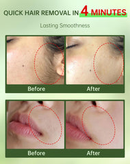 Zeponyx aplicación rápida en 4 minutos para labio superior.