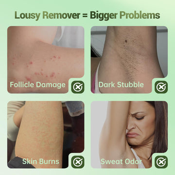 Zeponyx crema depilatoria sin dolor, experiencia suave para la piel