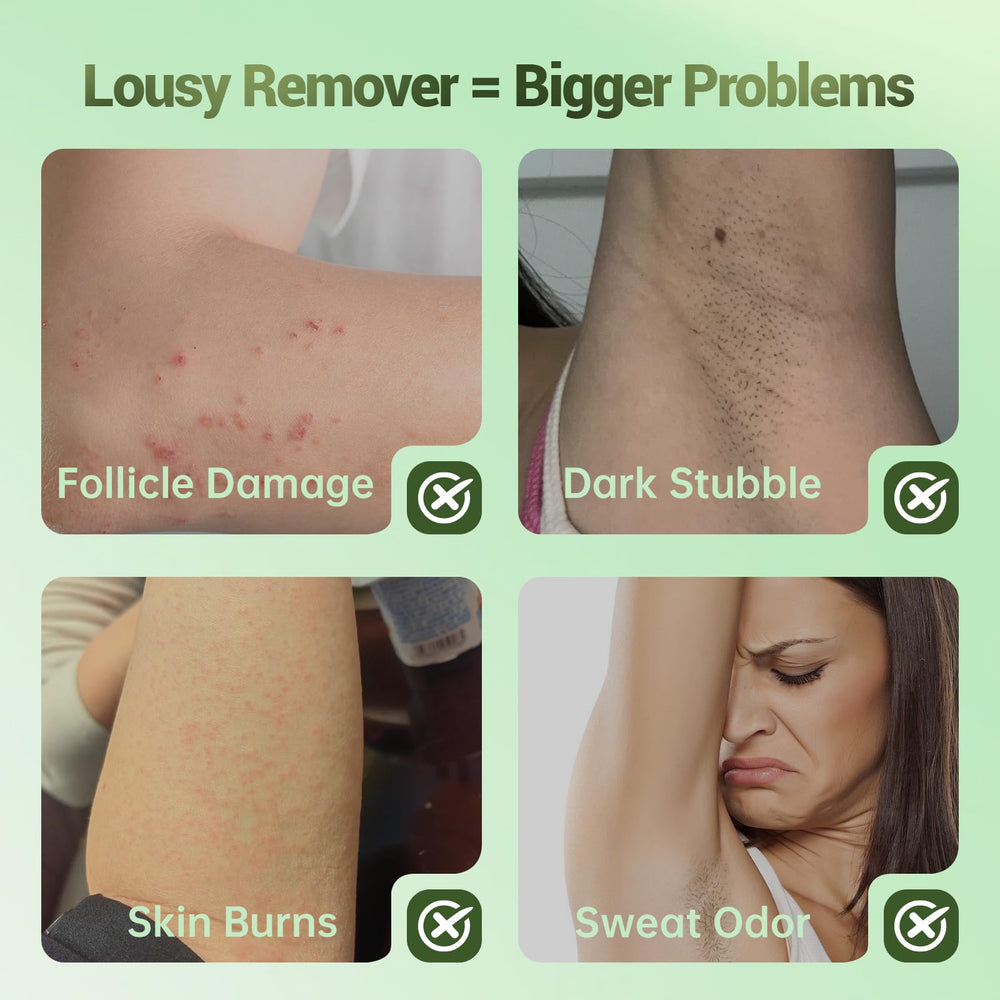 Zeponyx crema depilatoria sin dolor, experiencia suave para la piel
