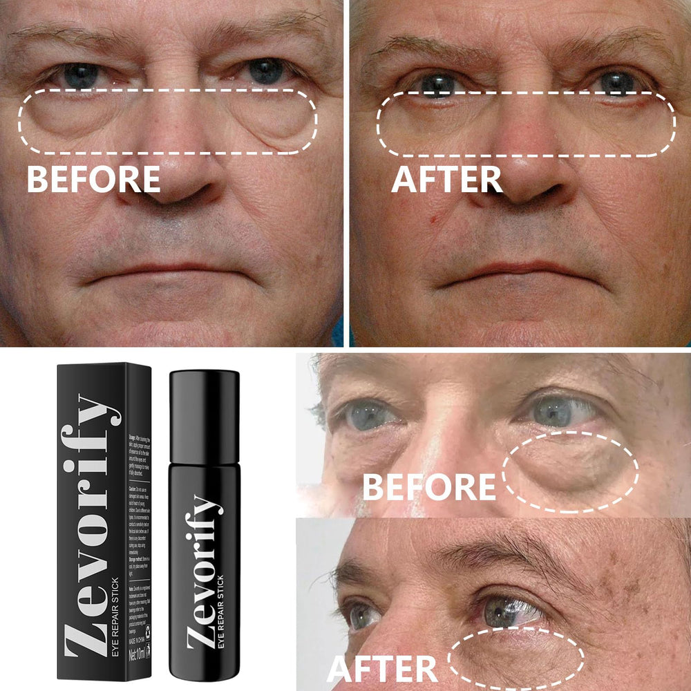 Zevorify barra hidratante de textura gel para ojos sensibles.