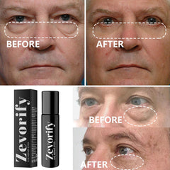 Zevorify barra hidratante de textura gel para ojos sensibles.