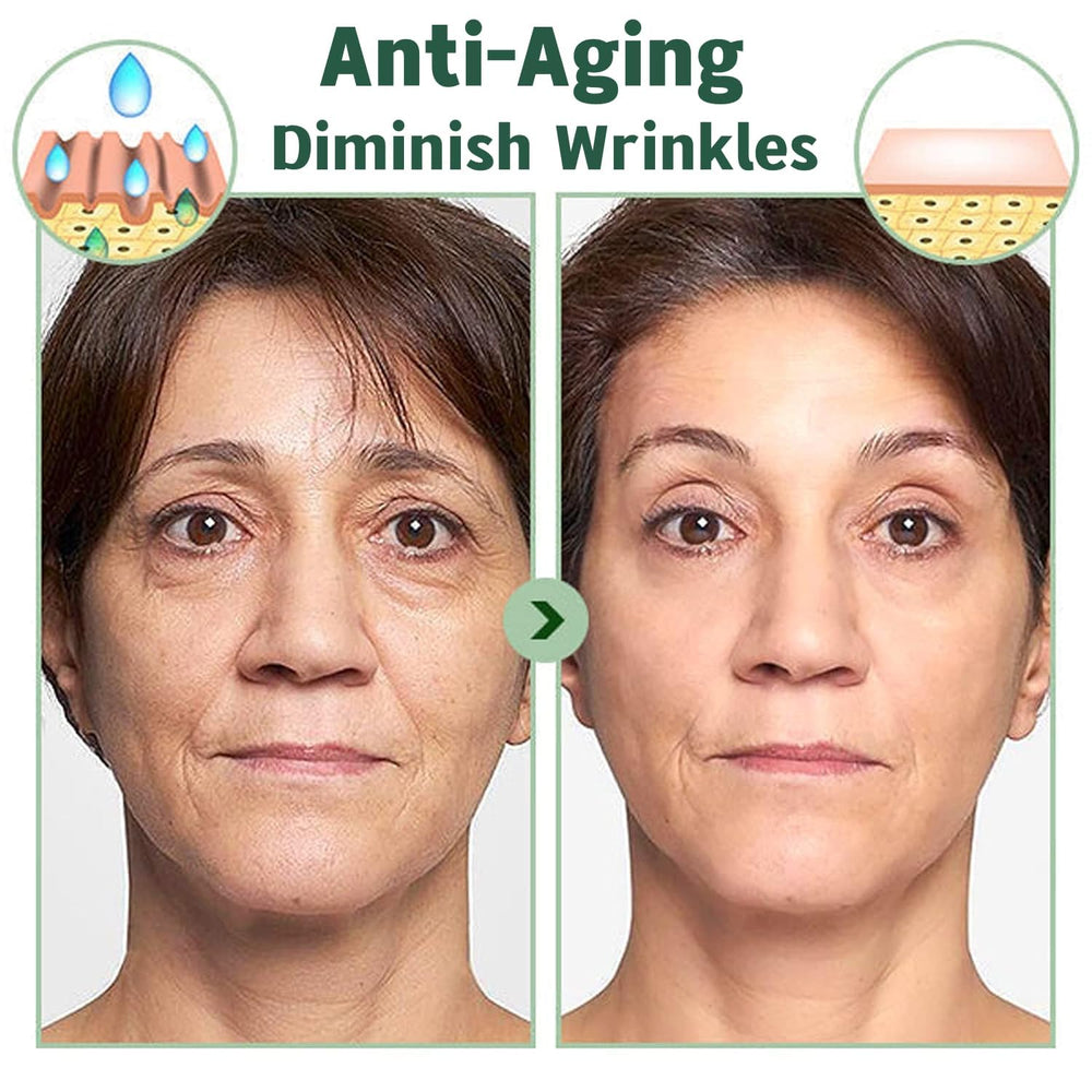 zhnnt aporta vitamina C y ácido hialurónico para hidratación prolongada
