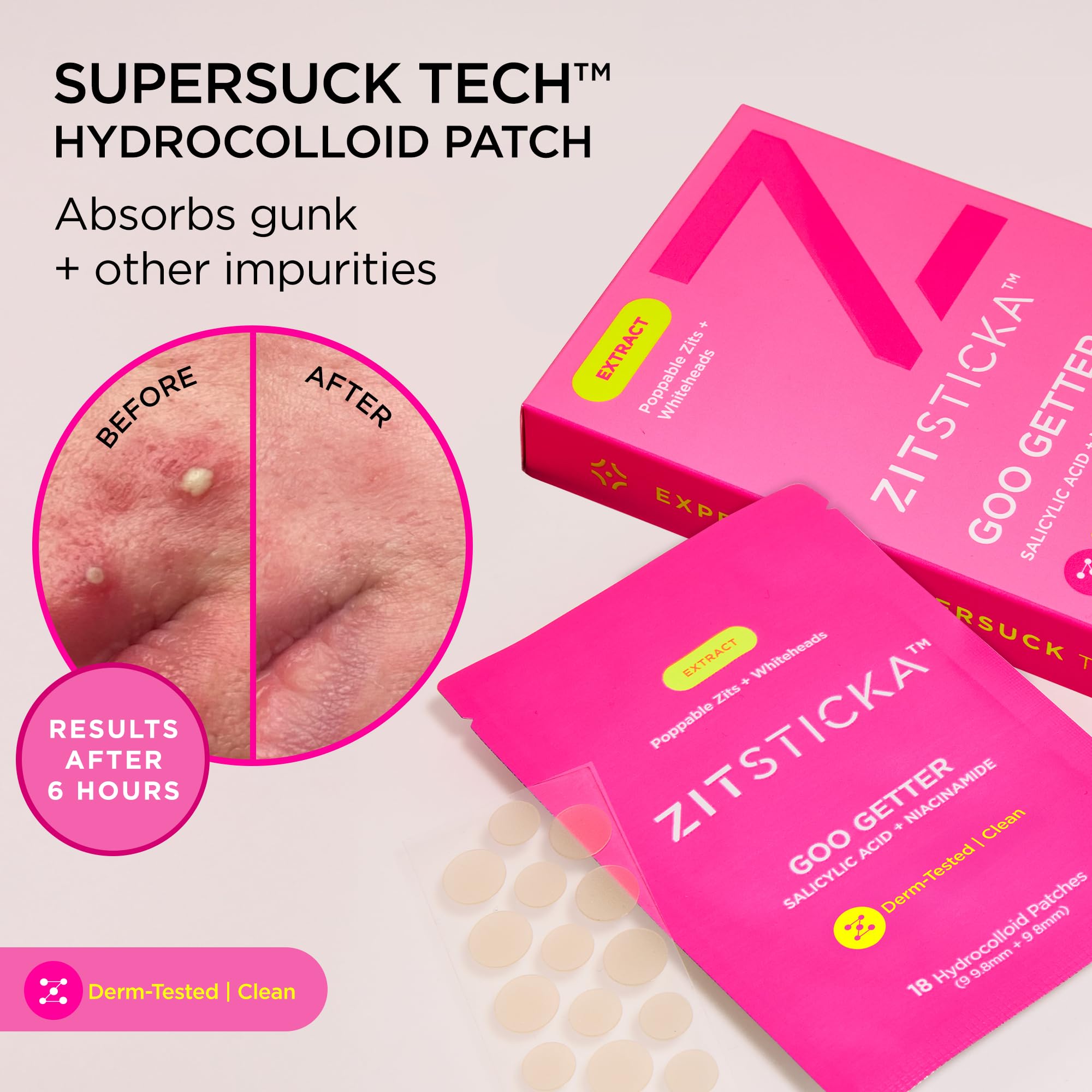 Ingrédient Niacinamide dans le patch ZitSticka Goo Getter pour l éclat ciblé.