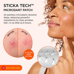 ZitSticka KILLA con microdardos penetrantes para tratamiento focalizado.