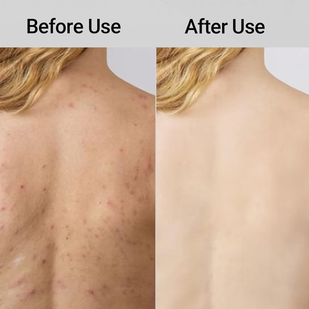 ZIVWAGX Blissal: exfoliación que mantiene poros limpios