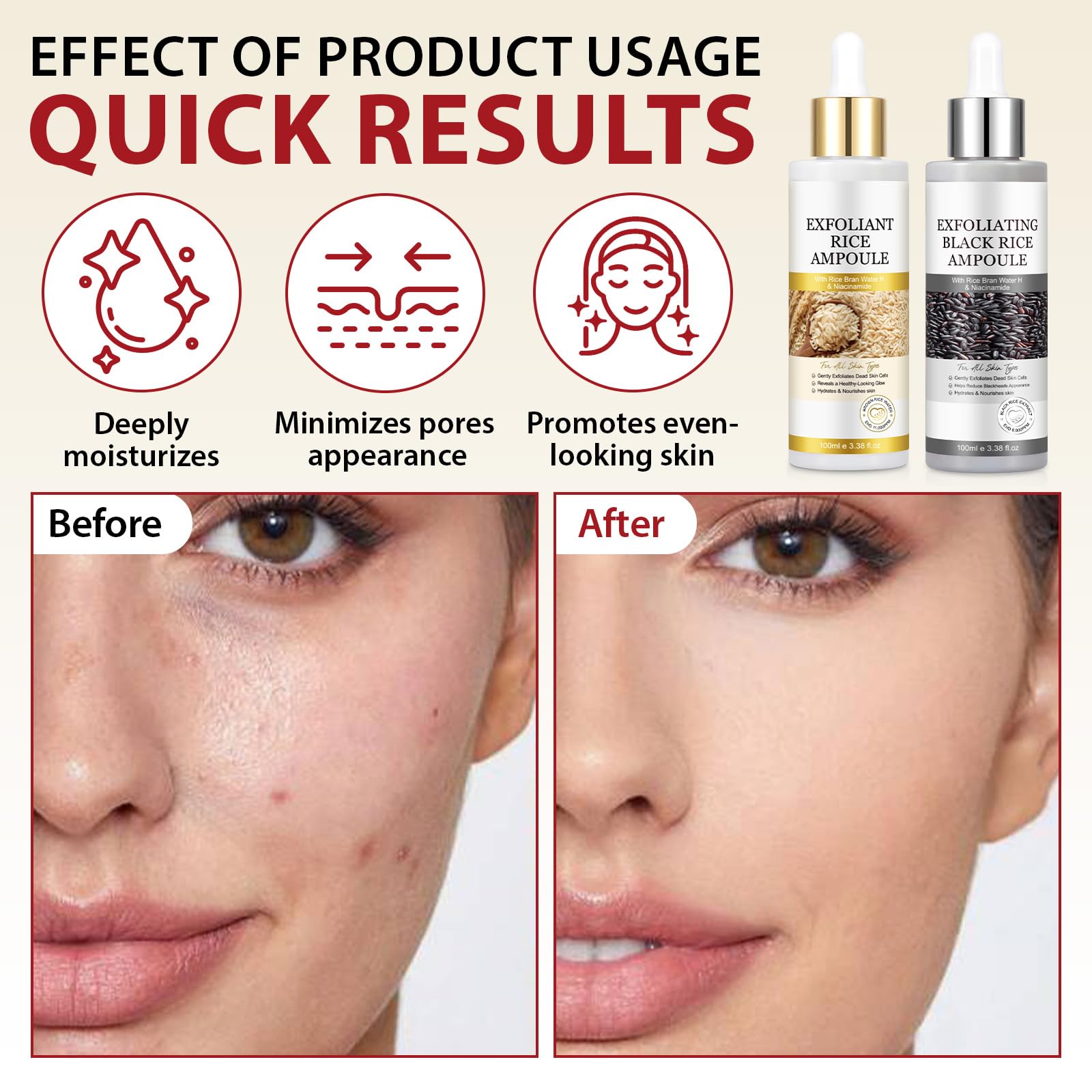 ZIXAOK dos ampollas exfoliante arroz, conjunto para consistencia