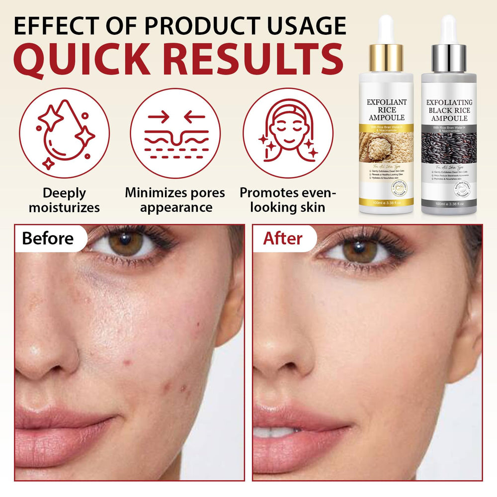 ZIXAOK dos ampollas exfoliante arroz, conjunto para consistencia