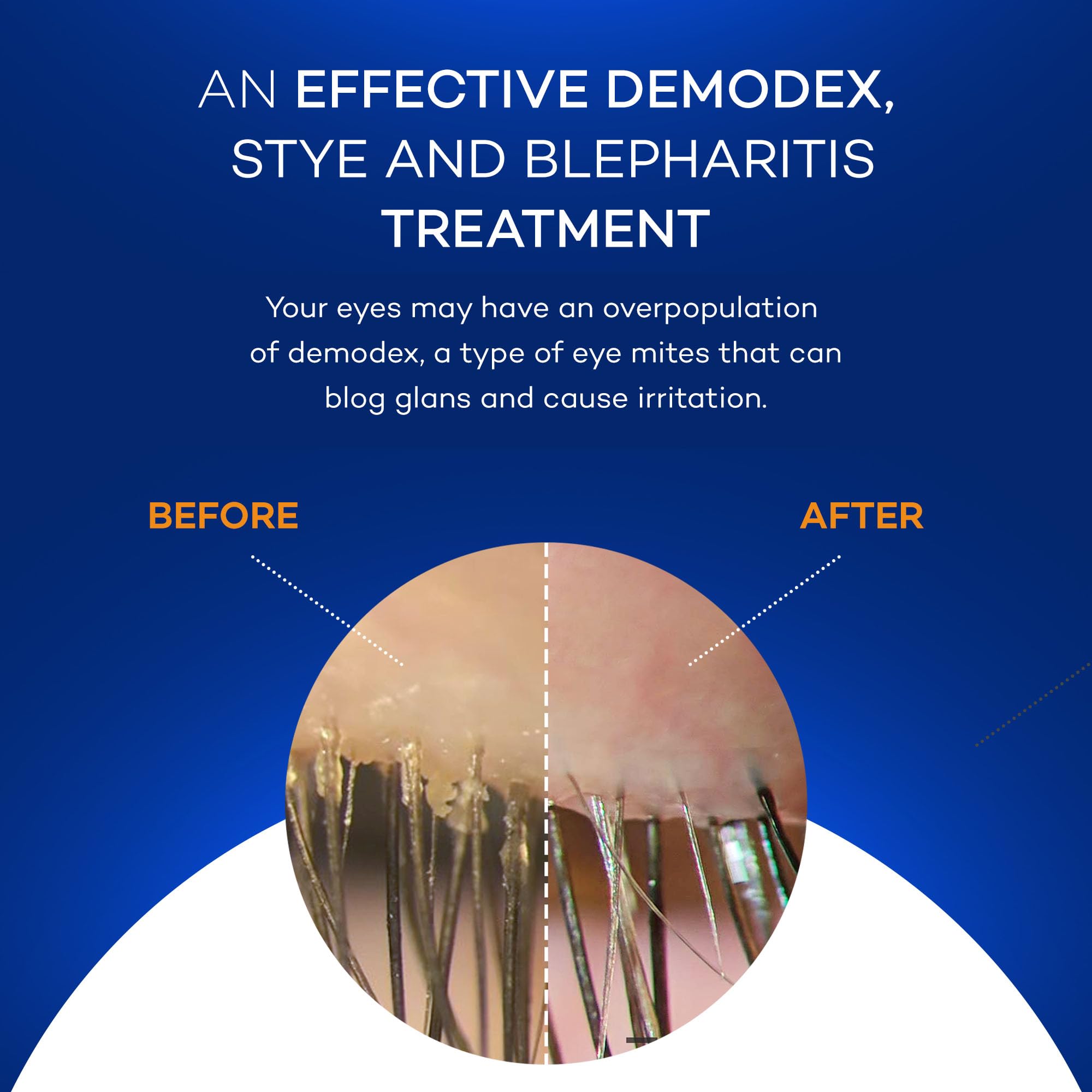 Zocular ZocuWipe: textura ligeramente humedecida facilita la limpieza sin fricción.