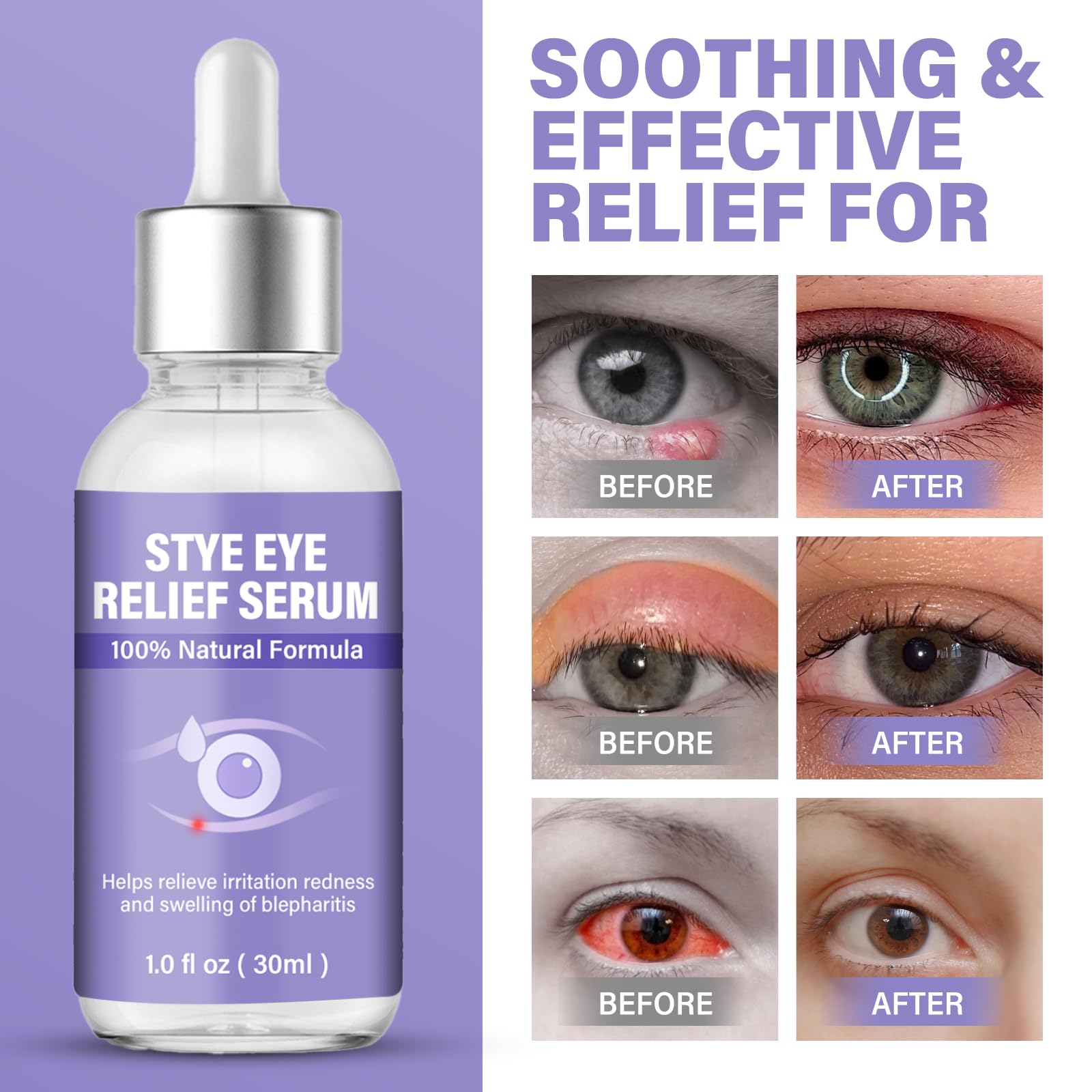 ZVBZVB gotero dosificación: control preciso de cada gota para aplicación limpia.