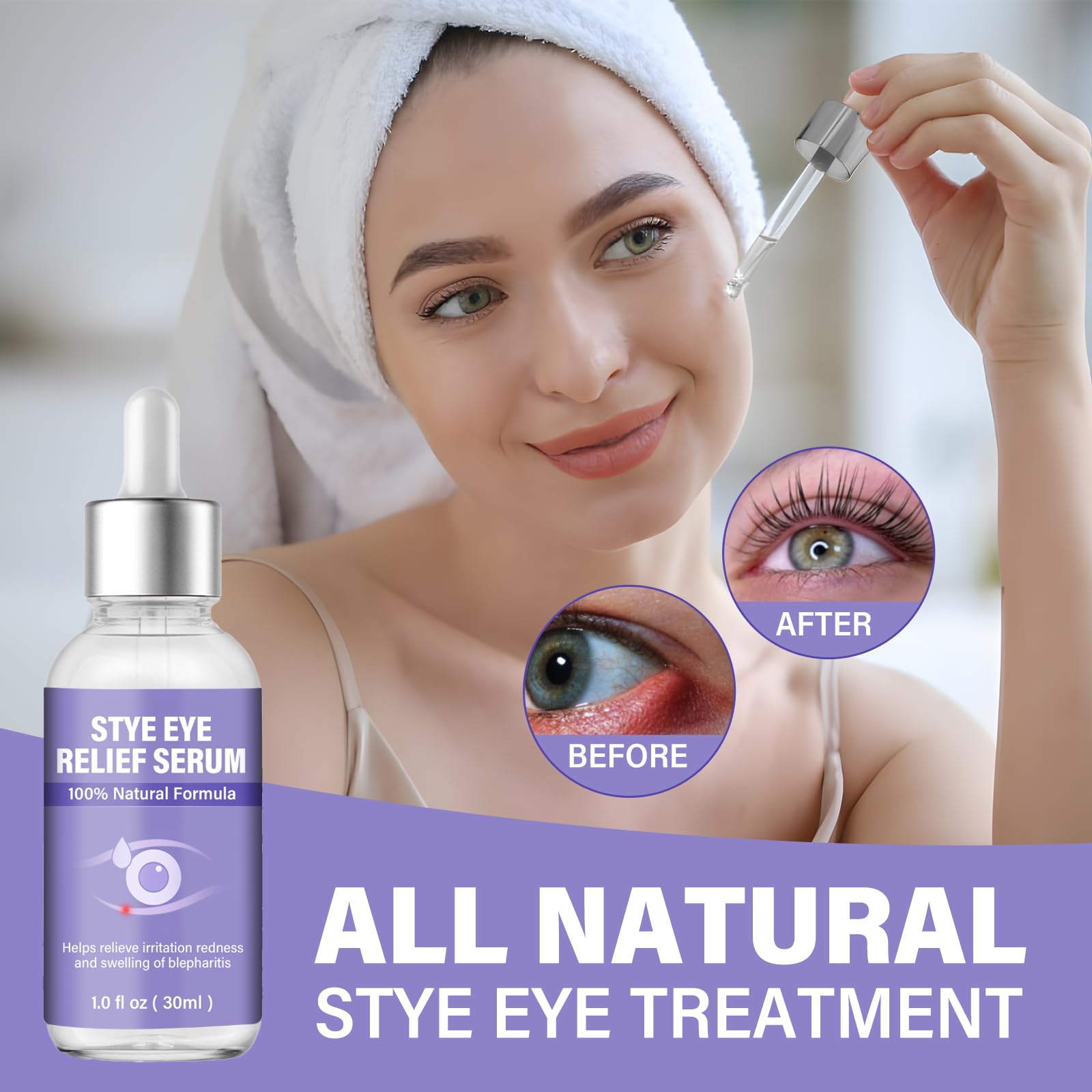 ZVBZVB serum para chalazion: ayuda a calmar la inflamación ocular con delicadeza.